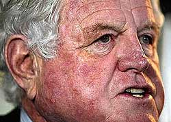 http://thepeoplescube.com/images/Ted_Kennedy_Drunk.jpg
