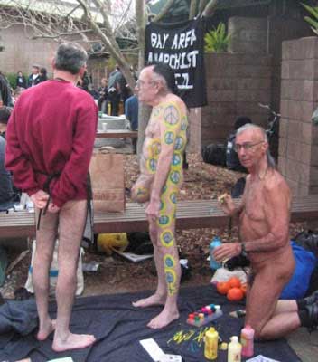 Scrotum_Inflation.jpg