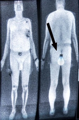 airport screening scan body picture-resized-600.jpg