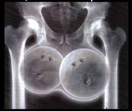 X-ray (white letter).jpg