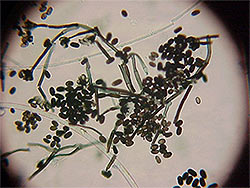 Black_Mold_Microscope.jpg