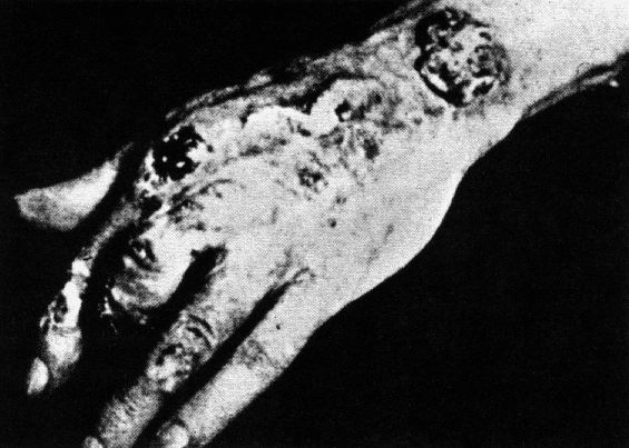 Radiation_Sickness-2.jpg