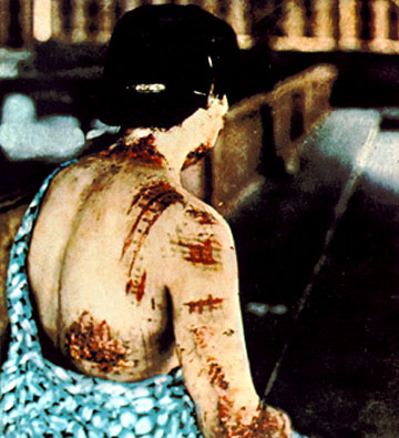 radiation-sickness2.jpg