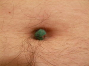 belly button.jpg