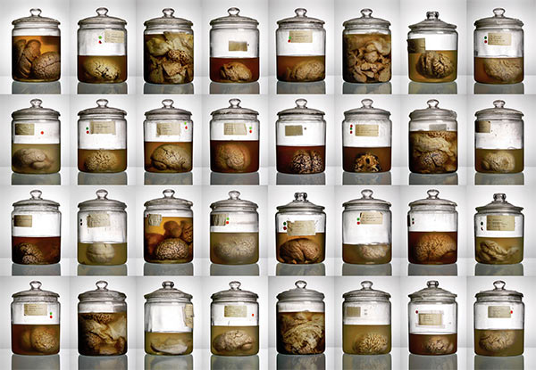 Brains_Jars.jpg