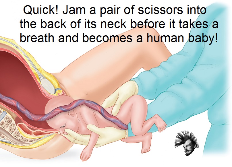Scissor Jam.jpg