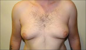 moobs.jpg