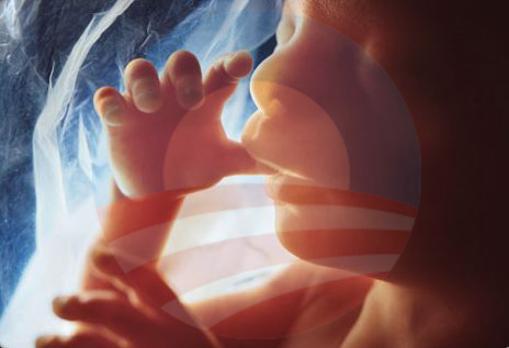 fetus.JPG