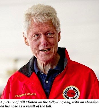 Bill_Clinton_Nose_Scratch.jpg